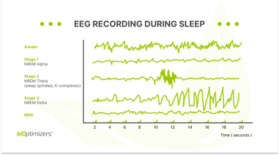 eeg graph